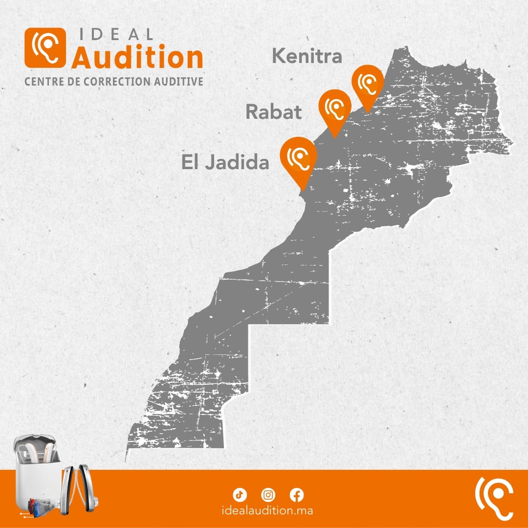 masterlys ideal post